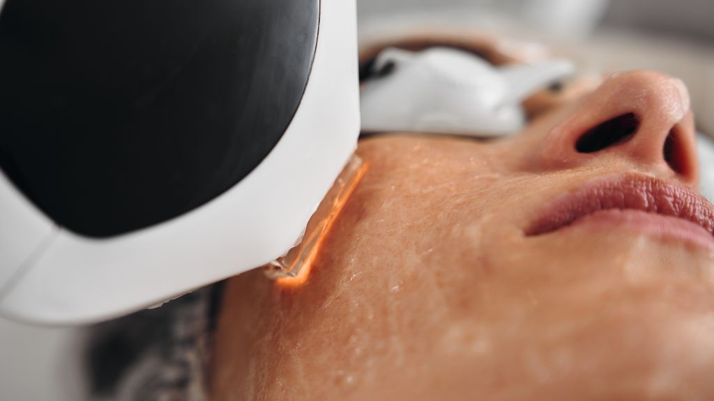 ipl photofacial washington dc