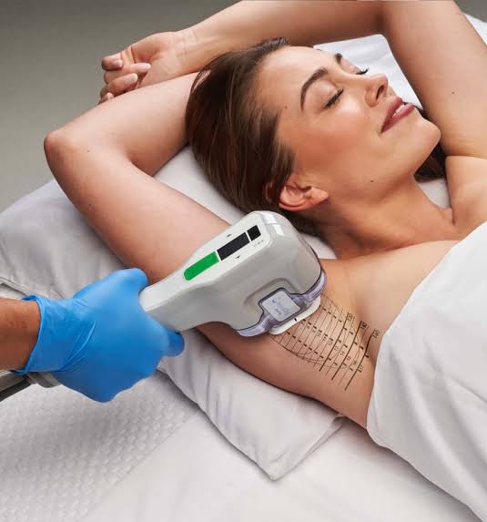 Miradry hyperhidrosis sweat treatment at medical cosmetic in Washington dc near dupont circle and Georgetown. Also Arlington Viriginia and Bethesda Maryland