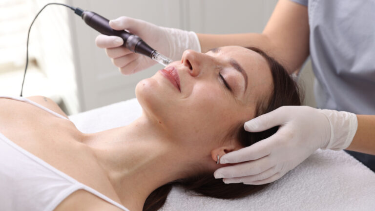 RF microneedling , Morpheus8 by Medical Cosmetic in Washington dc near Georgetown, Dupont Circle serving Arlington Virginia