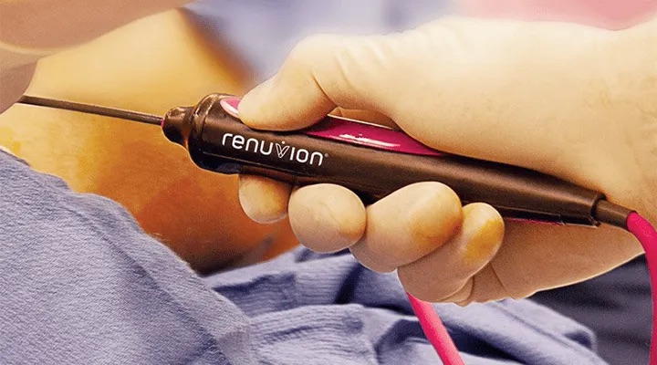 Renuvion, J-Plasma for skin tightening. tummy tuck, Medical Cosmetic in Washington dc , Dupont Circle , Georgetown also Bethesda Maryland and Arlington Virginia