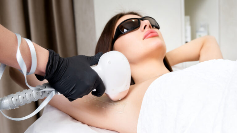 laser hair removal dc