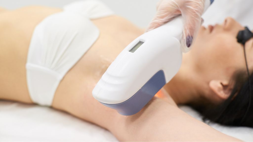 Laser Hair Removal