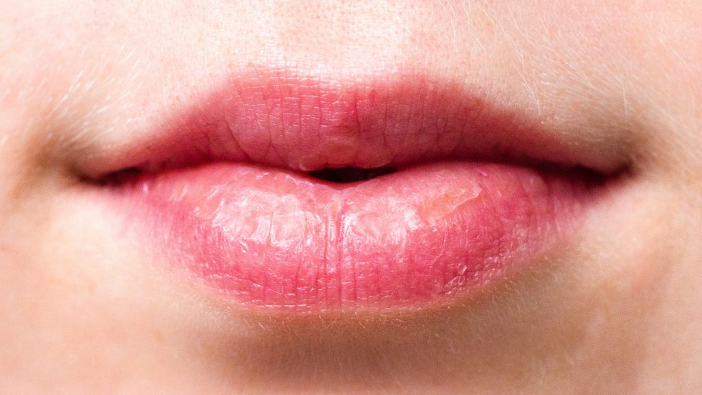 Lip Filler Enhancements