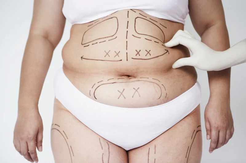 SlimLipo
