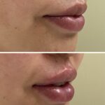 IMG 8894 1 min - medical cosmetic
