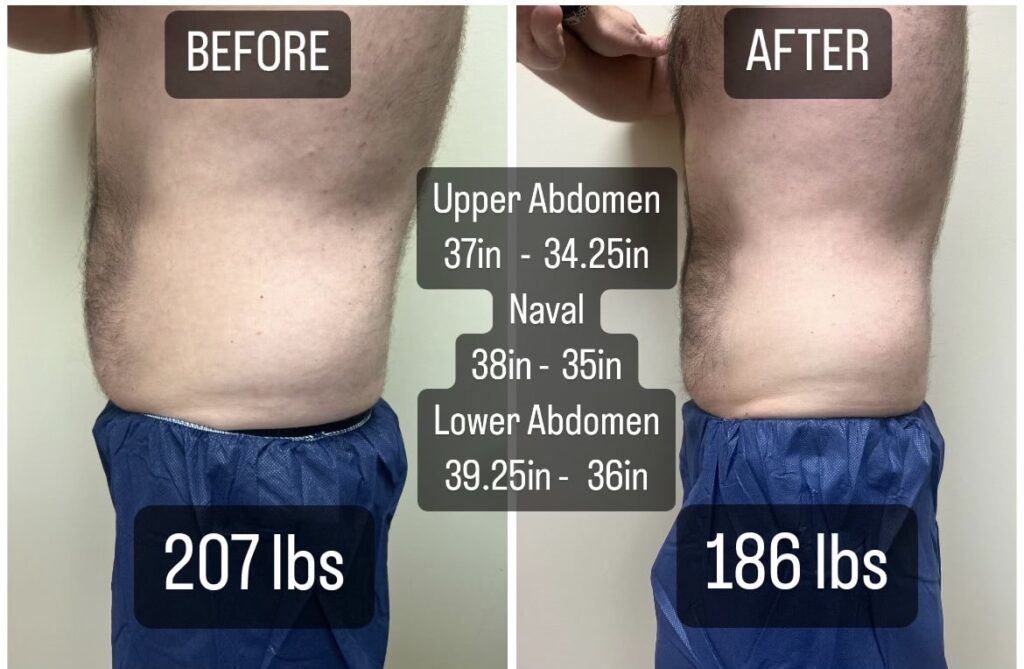 GLP-1 weight loss, Semaglutide, Tirzepatide, Zepbound, wegovy , monjauro, ozempic at medical Cosmetic, Georgetown, washington dc, Dupont Circle, Bethesda Maryland, Arlington Viriginia