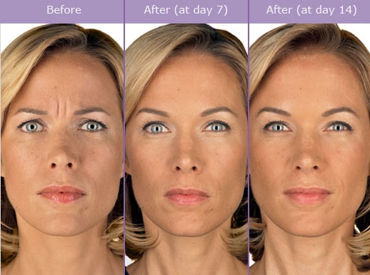 Botox medical cosmetic Dupont Circle